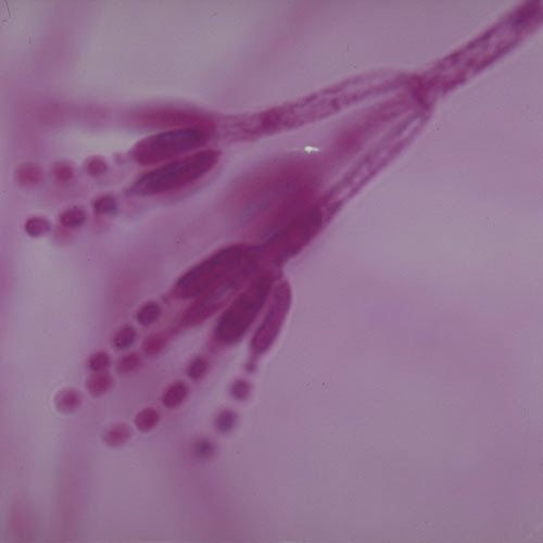 Pleseň penicillium Pleseň penicillium